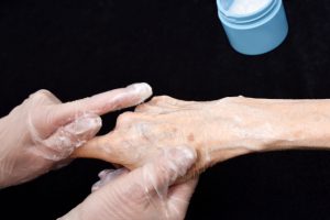 加齢で皮膚が剥がれる「スキンテア」問題 保湿が重要
